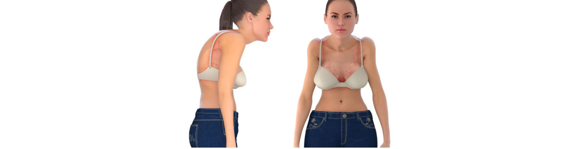 Why is wearing the wrong bra size bad?