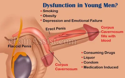 What is Erectile Dysfunction